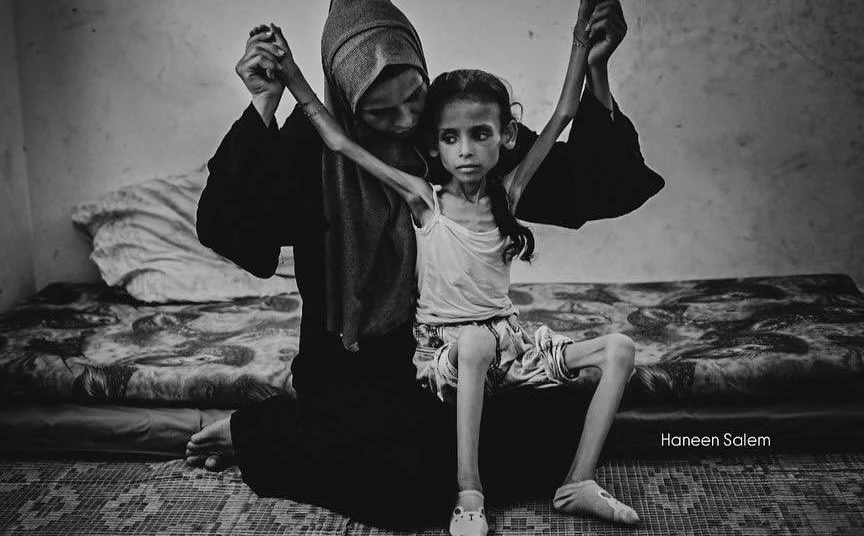 Gaza, escenario apocalíptico en el que los niños mueren por inanición